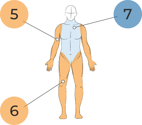 Sketch of body with the arms shaded in orange, the neck and torso shaded in light blue, and the legs shaded in beige. The numbers 5, 6, and 7 sit outside of the sketch, with a callout line between the number 5 and the right arm, a callout line between the number 6 and the lower extremities, and a callout line between the number 7 and the shoulders.